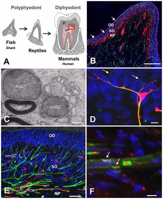 Schwann Cell Responses and Plasticity in Different Dental Pulp Scenarios